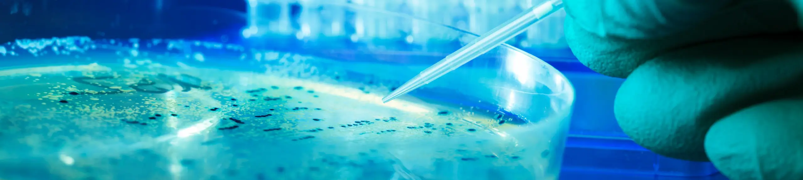 Salmonella testing Salmonella testing