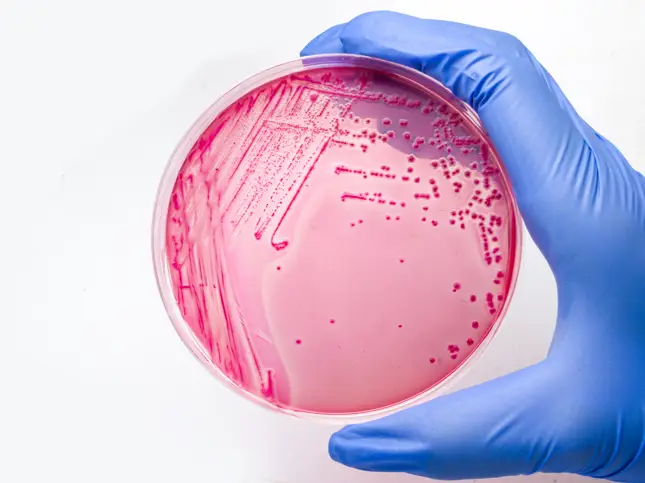 Coliform Bacteria in Water Test | CTS