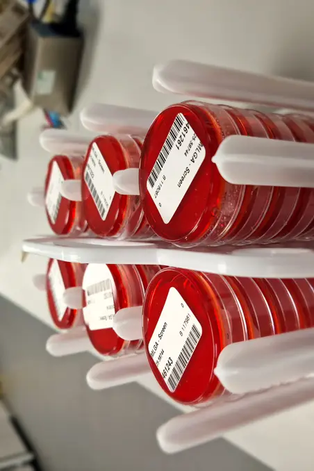 MLGA agar MLGA agar